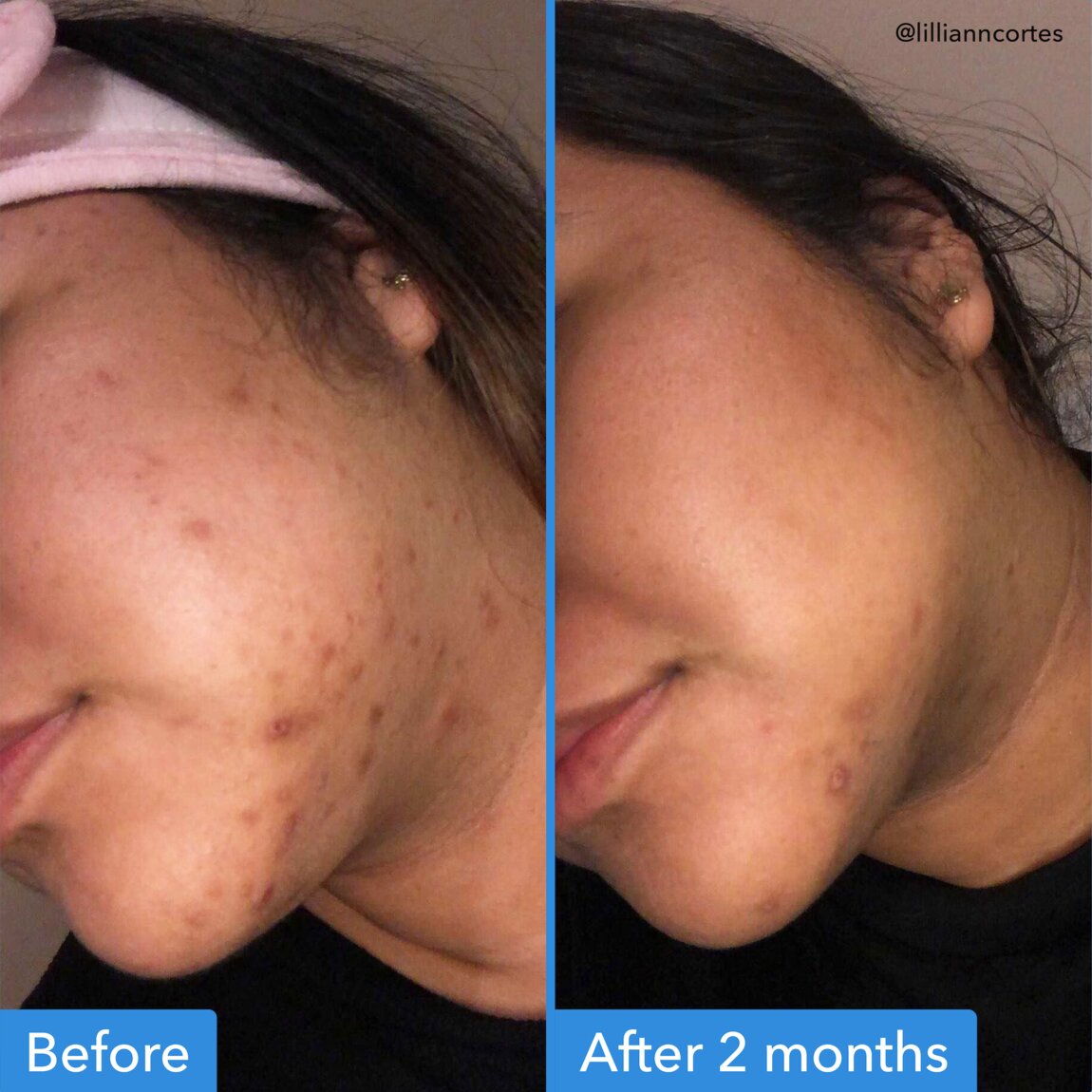 discoloration-correcting-serum-j5 zb_p.jpg