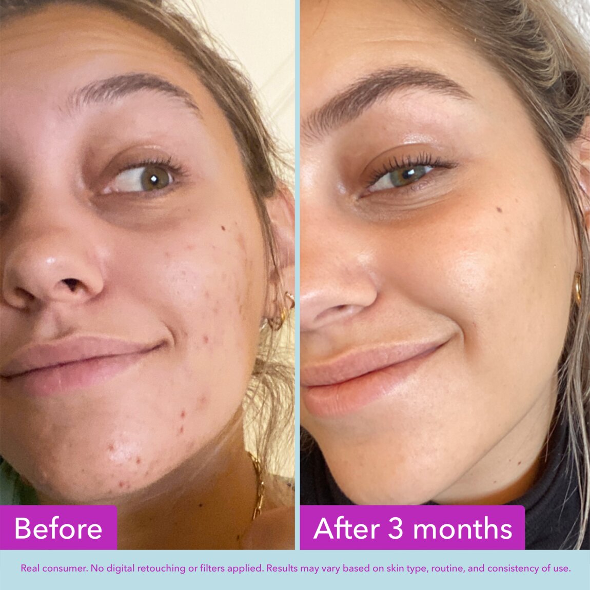niacinamide-brightening-toner-x8 zb_p.jpg