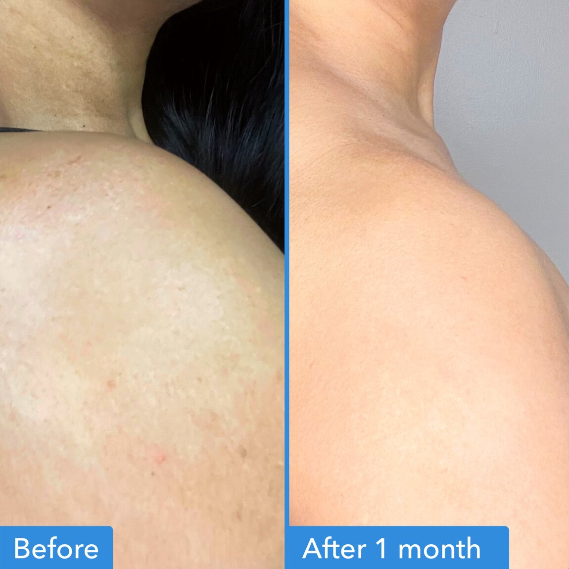 discoloration-correcting-body-treatment-l7 zb_p.jpg